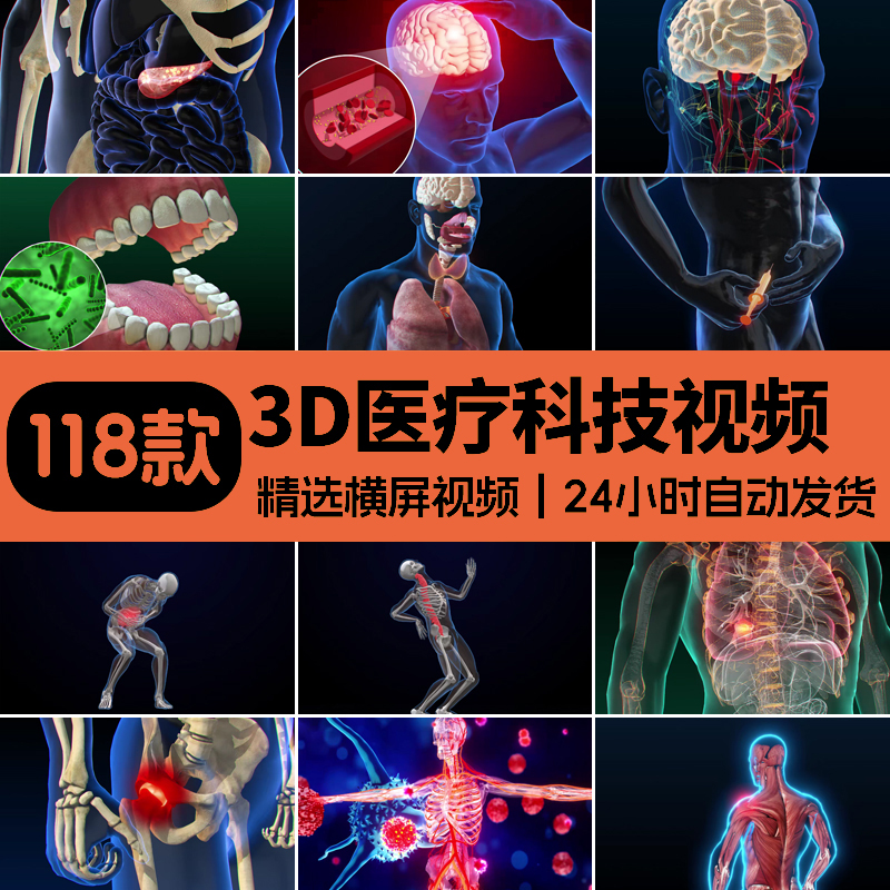 图片[1]-医疗3D科技健康疾病三维大脑骨骼人体器官医学动画演示片视频素材-梵摄创意库